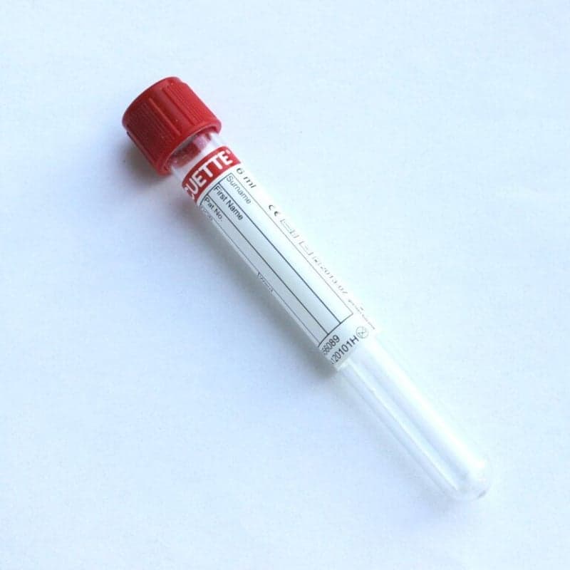 Pruebas de sangre y otras muestras